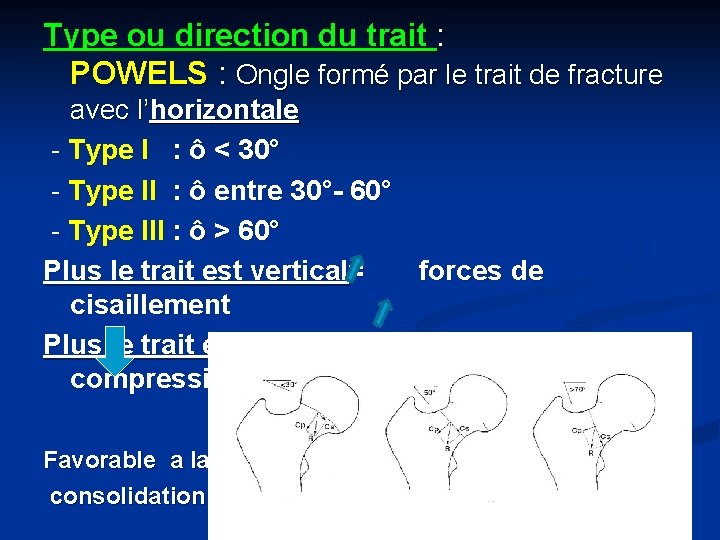 Type ou direction du trait : POWELS : Ongle formé par le trait de