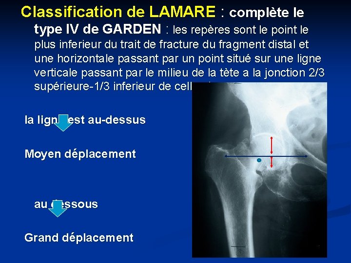 Classification de LAMARE : complète le type IV de GARDEN : les repères sont