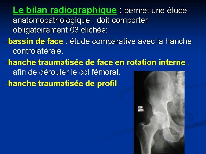 Le bilan radiographique : permet une étude anatomopathologique , doit comporter obligatoirement 03 clichés: