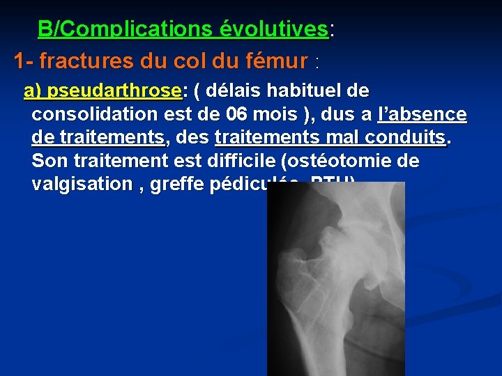 B/Complications évolutives: 1 - fractures du col du fémur : a) pseudarthrose: ( délais