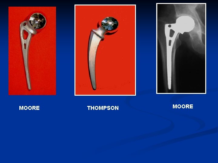 MOORE THOMPSON MOORE 