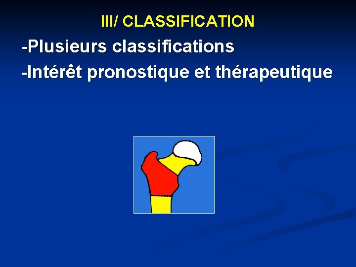 III/ CLASSIFICATION -Plusieurs classifications -Intérêt pronostique et thérapeutique 