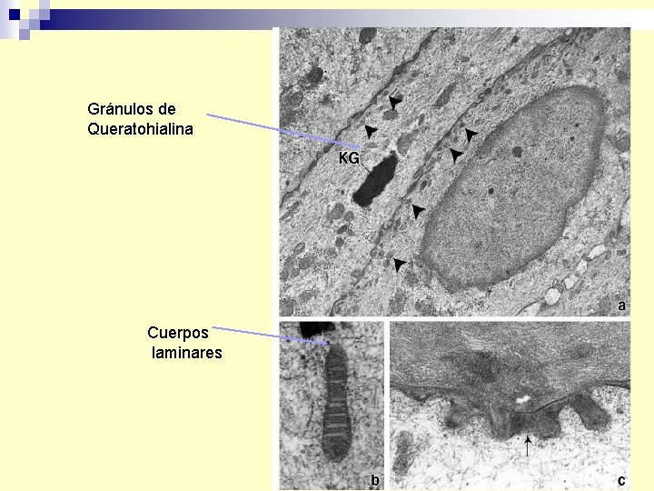 Gránulos de Queratohialina Cuerpos laminares 
