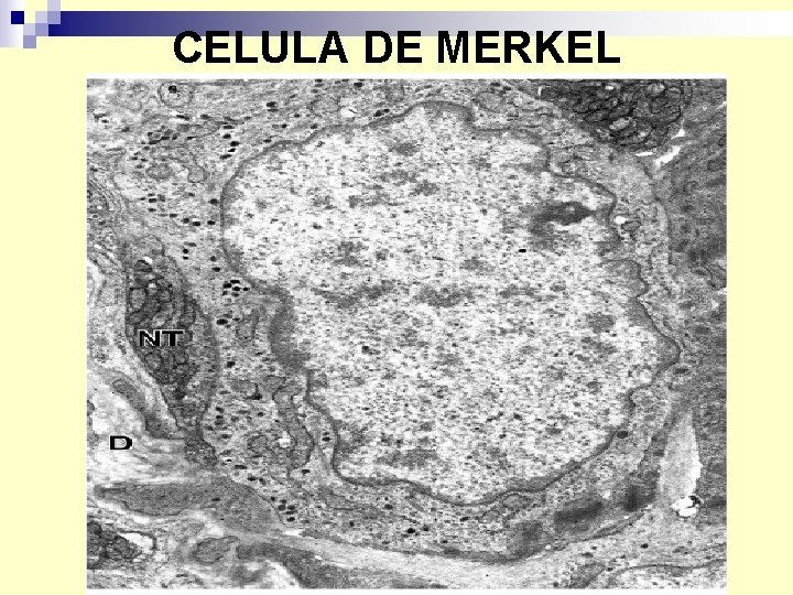 CELULA DE MERKEL 