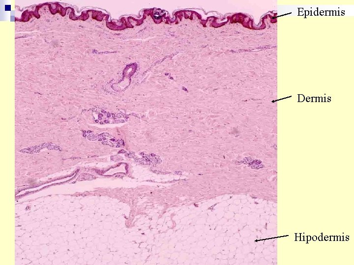 Epidermis Dermis Hipodermis 