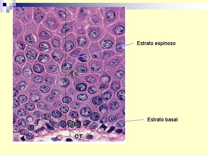 Estrato espinoso Estrato basal 