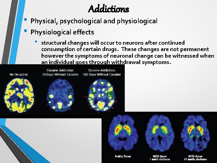 Addictions • Physical, psychological and physiological • Physiological effects • structural changes will occur