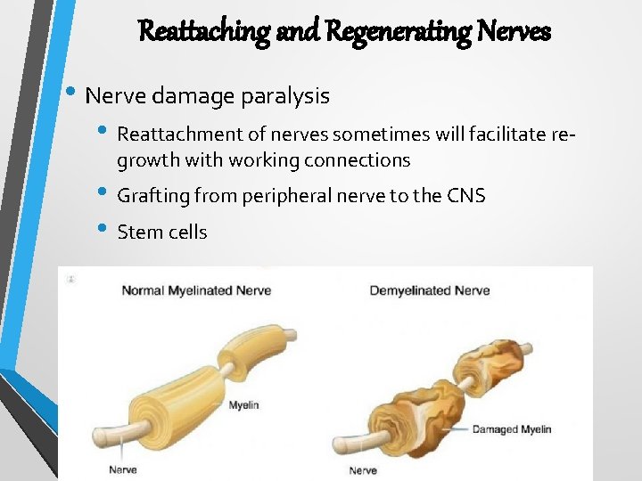 Reattaching and Regenerating Nerves • Nerve damage paralysis • Reattachment of nerves sometimes will