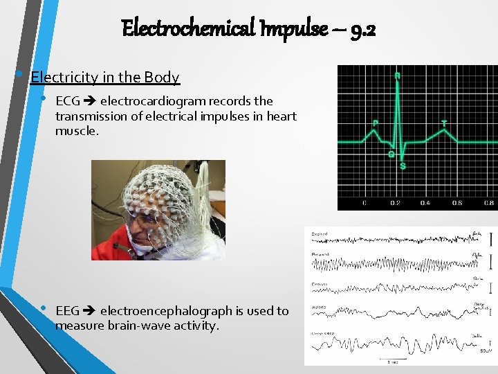 Electrochemical Impulse – 9. 2 • Electricity in the Body • ECG electrocardiogram records