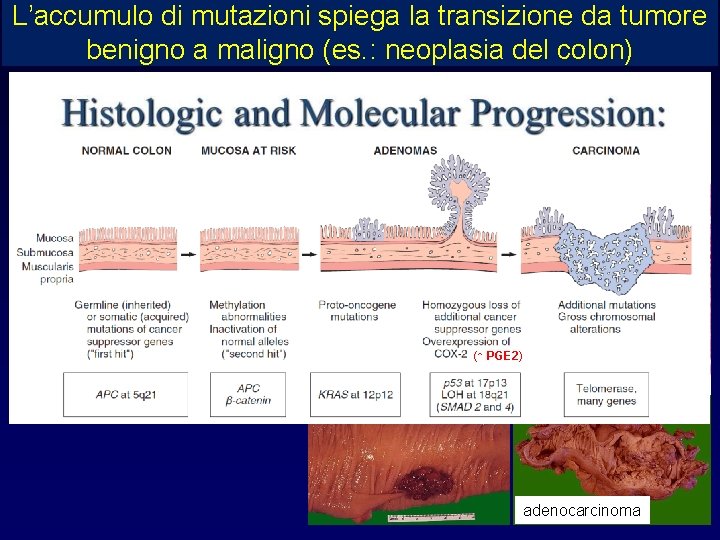 L’accumulo di mutazioni spiega la transizione da tumore benigno a maligno (es. : neoplasia