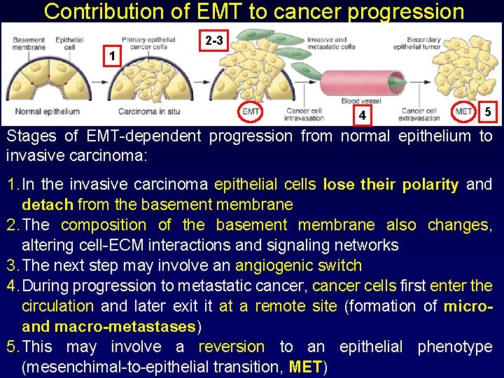 Contribution of EMT to cancer progression 2 -3 1 4 5 Stages of EMT-dependent