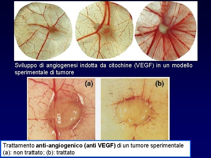 Sviluppo di angiogenesi indotta da citochine (VEGF) in un modello sperimentale di tumore Trattamento