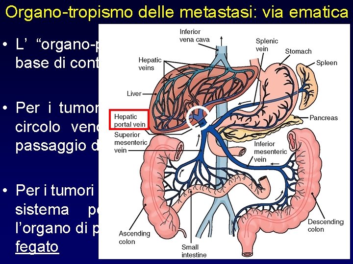 Organo-tropismo delle metastasi: via ematica • L’ “organo-preferenza” si può spiegare sulla base di