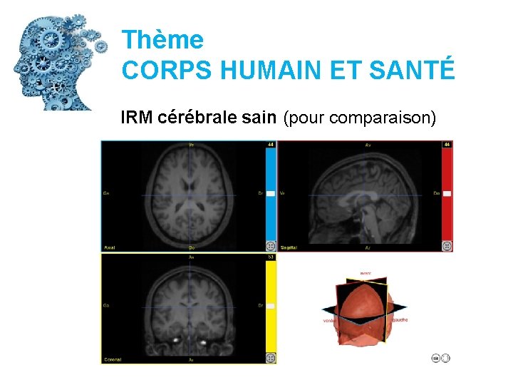 Thème CORPS HUMAIN ET SANTÉ IRM cérébrale sain (pour comparaison) 