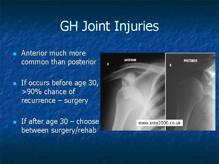 GH Joint Injuries n n n Anterior much more common than posterior If occurs
