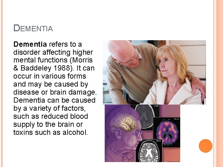 DEMENTIA Dementia refers to a disorder affecting higher mental functions (Morris & Baddeley 1988).