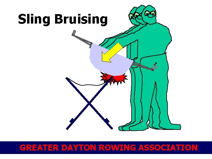 Sling Bruising GREATER DAYTON ROWING ASSOCIATION 