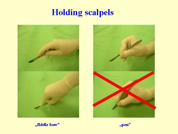 Holding scalpels „fiddle bow” „pen” Holding scalpels „fiddle bow” „pen”