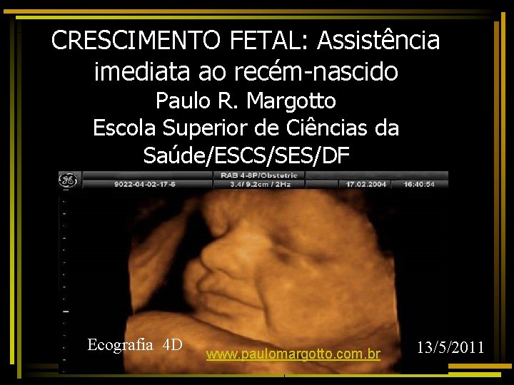 CRESCIMENTO FETAL: Assistência imediata ao recém-nascido Paulo R. Margotto Escola Superior de Ciências da
