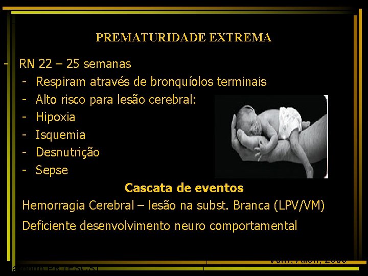 PREMATURIDADE EXTREMA Prematuridade Extrema: um dilema continuo - RN 22 – 25 semanas -