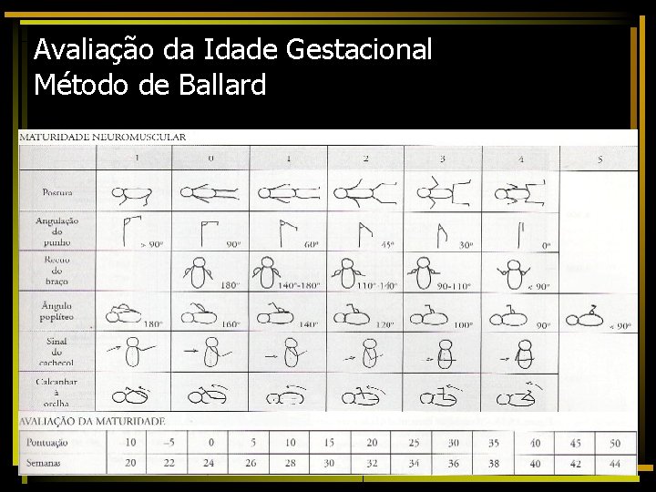 Avaliação da Idade Gestacional Método de Ballard 