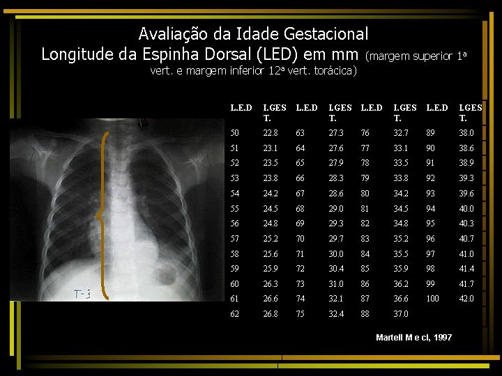 Avaliação da Idade Gestacional Longitude da Espinha Dorsal (LED) em mm (margem superior 1