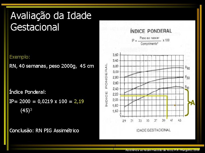 Avaliação da Idade Gestacional Exemplo: RN, 40 semanas, peso 2000 g, 45 cm Índice