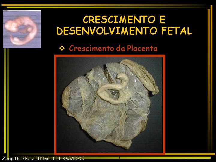 CRESCIMENTO E DESENVOLVIMENTO FETAL v Crescimento da Placenta Margotto, PR. Unid Neonatol HRAS/ESCS 