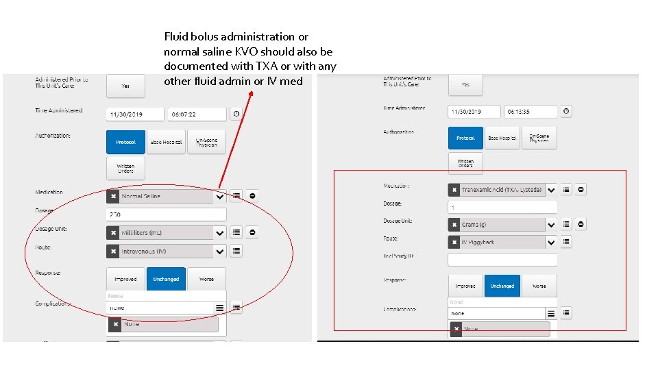 Fluid bolus administration or normal saline KVO should also be documented with TXA or