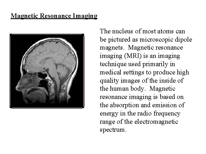 Magnetic Resonance Imaging The nucleus of most atoms can be pictured as microscopic dipole
