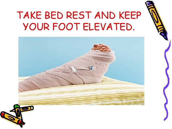 TAKE BED REST AND KEEP YOUR FOOT ELEVATED. 