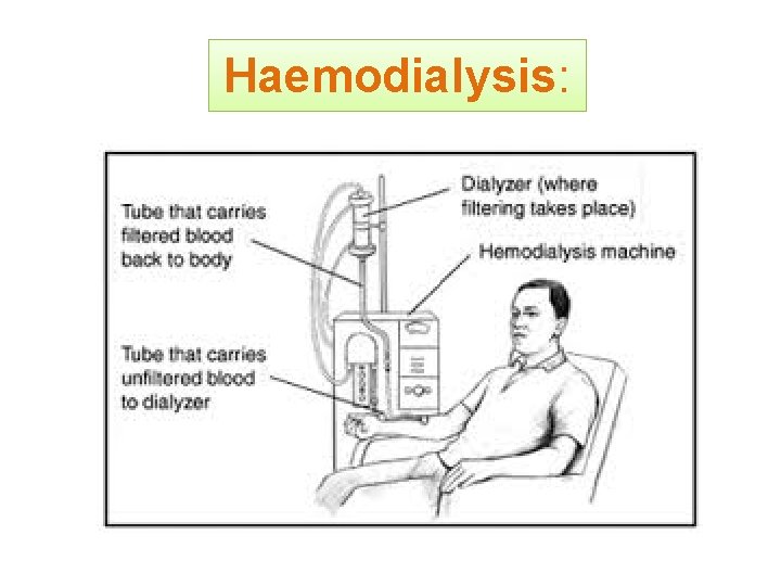 Haemodialysis: 