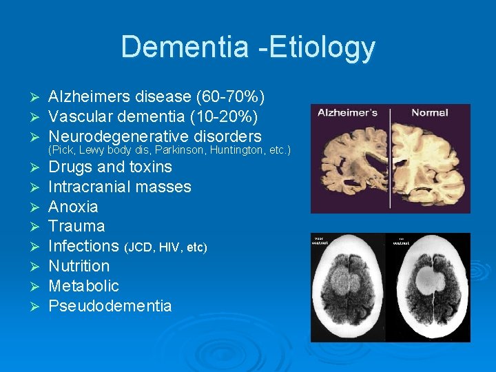 Dementia -Etiology Ø Ø Ø Alzheimers disease (60 -70%) Vascular dementia (10 -20%) Neurodegenerative