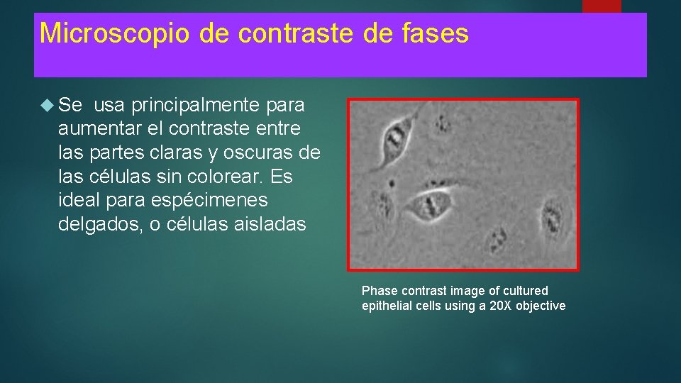 Microscopio de contraste de fases Se usa principalmente para aumentar el contraste entre las