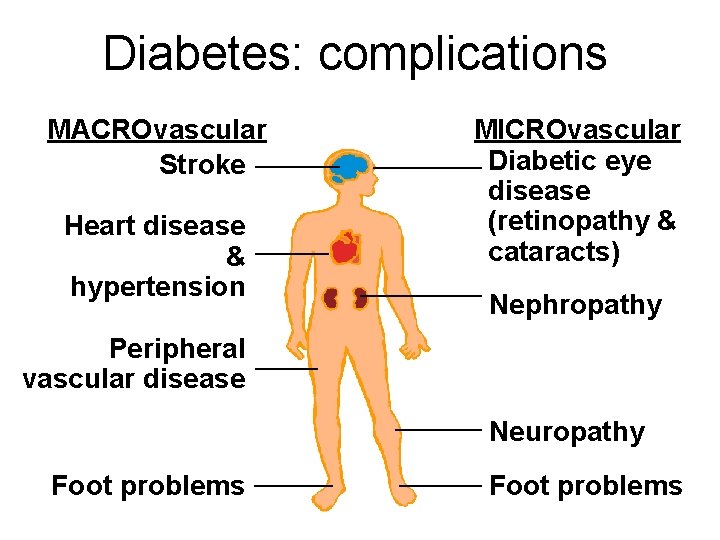 Diabetes: complications MACROvascular Stroke Heart disease & hypertension MICROvascular Diabetic eye disease (retinopathy &