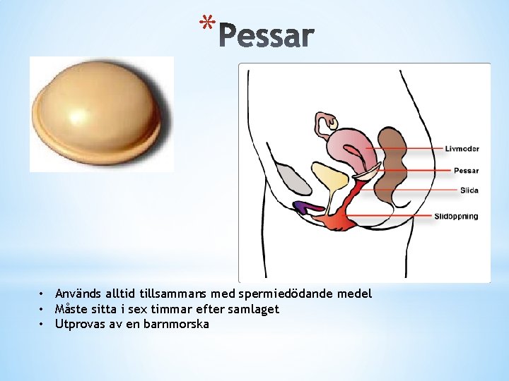 * • Används alltid tillsammans med spermiedödande medel • Måste sitta i sex timmar