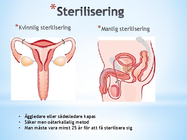 * *Kvinnlig sterilisering *Manlig sterilisering • Äggledare eller sädesledare kapas • Säker men oåterkallelig