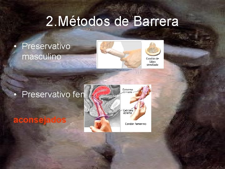 2. Métodos de Barrera • Preservativo masculino • Preservativo femenino aconsejados 