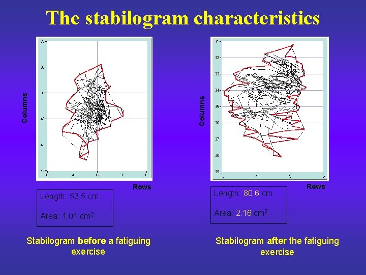 Columns The stabilogram characteristics Rows Length: 53. 5 cm Length: 80. 6 cm Area: