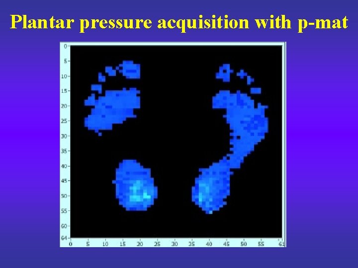 Plantar pressure acquisition with p-mat 