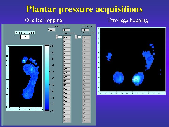 Plantar pressure acquisitions One leg hopping Two legs hopping 