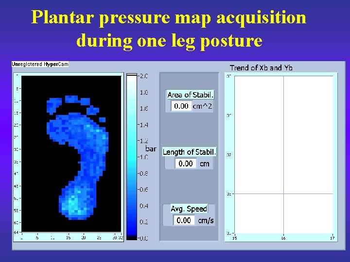 Plantar pressure map acquisition during one leg posture 