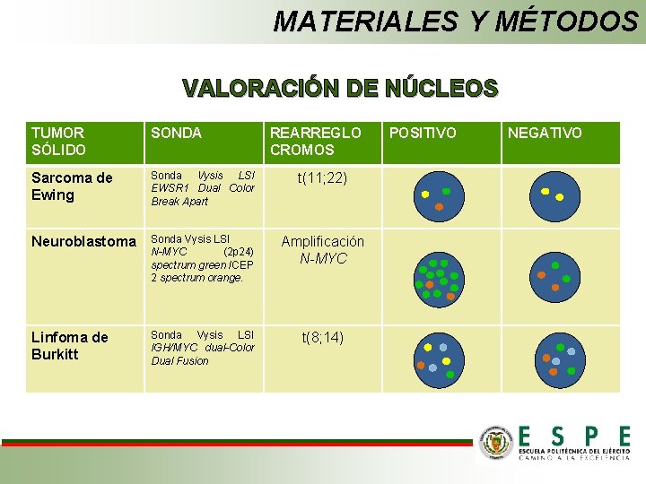 MATERIALES Y MÉTODOS VALORACIÓN DE NÚCLEOS TUMOR SÓLIDO SONDA REARREGLO CROMOS Sarcoma de Ewing