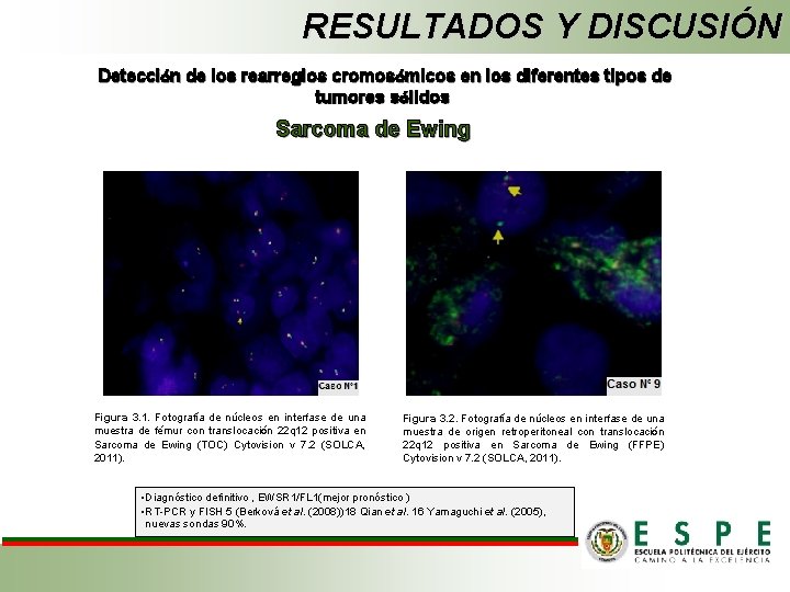 RESULTADOS Y DISCUSIÓN Detección de los rearreglos cromosómicos en los diferentes tipos de tumores