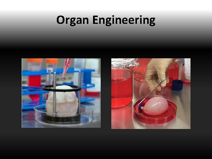 Organ Engineering 