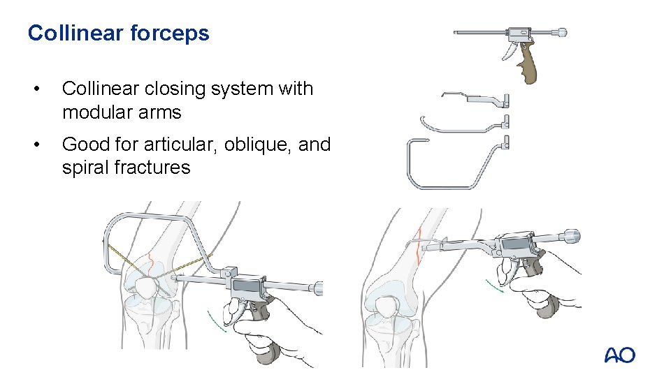 Collinear forceps • Collinear closing system with modular arms • Good for articular, oblique,