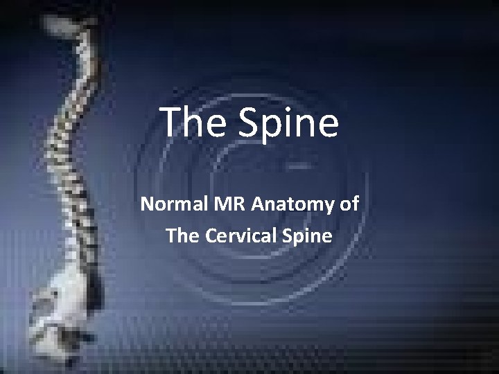 The Spine Normal MR Anatomy of The Cervical Spine The Spine Normal MR Anatomy of The Cervical Spine