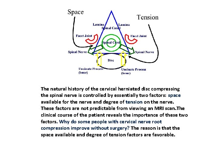 The natural history of the cervical herniated disc compressing the spinal nerve is controlled The natural history of the cervical herniated disc compressing the spinal nerve is controlled