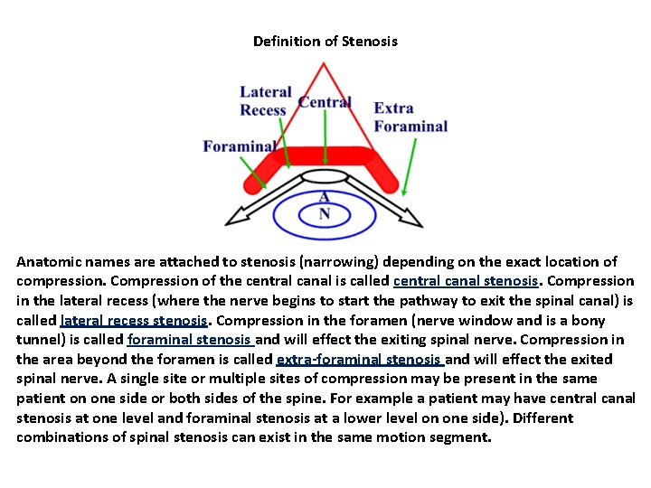Definition of Stenosis Anatomic names are attached to stenosis (narrowing) depending on the exact Definition of Stenosis Anatomic names are attached to stenosis (narrowing) depending on the exact