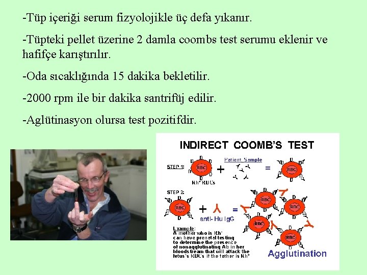 -Tüp içeriği serum fizyolojikle üç defa yıkanır. -Tüpteki pellet üzerine 2 damla coombs test